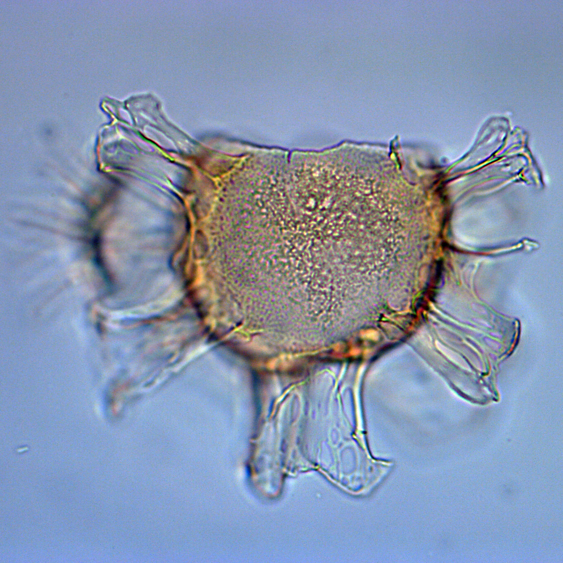 Glaphyrocysta sp., 1410C-9H-4, 15-17, H20, foto-d.jpg